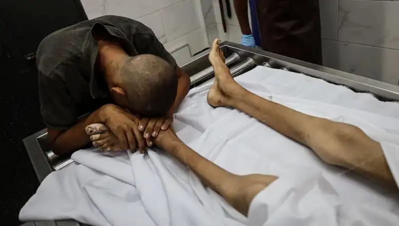 Gazze’de Açlık Sınırında Bir Çocuk Daha Hayatını Kaybetti