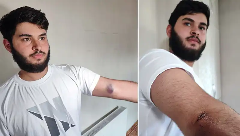 Mahallede Kaçan Top Krizi: Conoların Kamyoneti Ortalığı Karıştırdı!